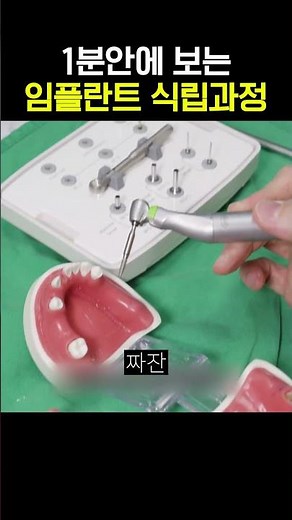 임플란트 과정 1분요악