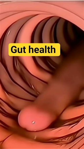 Intestinal Problems Explained in 3D | Causes, Symptoms & Treatment of Digestive Disorders