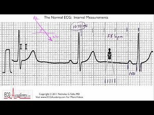 ECG Interpretation, Interval Measurements, Part 6-4  • Video • MEDtube.net