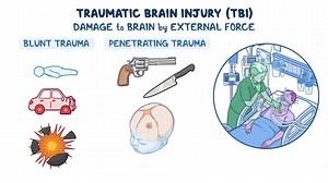 Video: Critical Care - Traumatic Brain Injury - Video Explanation! | Osmosis | Osmosis
