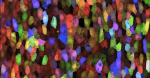 Researchers Turn Zebrafish Technicolor to Reveal How Skin Regenerates