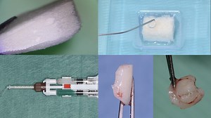 Socket preservation | Zerodonto | Dentistry in Blog