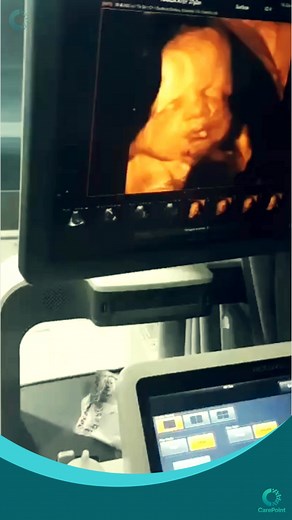 306 reactions · 87 comments |  في Care Point، إحنا فاهمين إن لحظة...