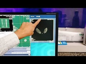 Live demo of mri lower leg CE on GE, sequence and planning.