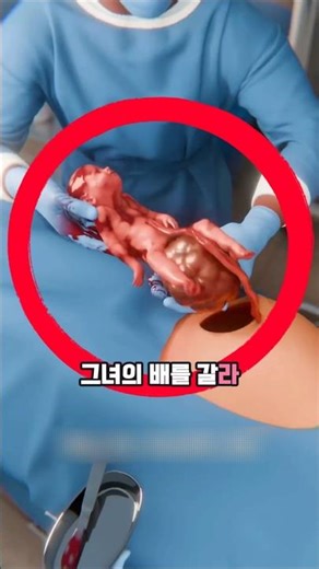세상에서 유일한 두번 태어난 아기‼️😱👶