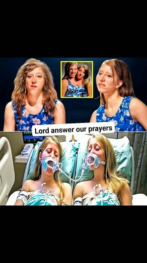 119K views · 579 reactions | "The world is heartbroken. Doctors have confirmed that Abby and Brittany Hensel’s recent surgery faced serious complications. The beloved conjoined twins—whose courage has inspired millions—are now in recovery as their family and fans rally around them. Despite the setback, their story remains one of resilience, hope, and the unbreakable bond of sisterhood.  | Testimony Ruth | Facebook