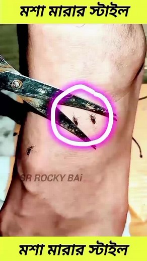 Removing Ticks Safely: Step-by-Step Guide