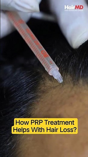 How PRP Treatment Helps With Hair Loss? | Does It Actually Work? | HairMD Clinic, Pune