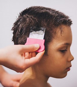 Hair Loss In Children: 8 Common Causes And Prevention Tips