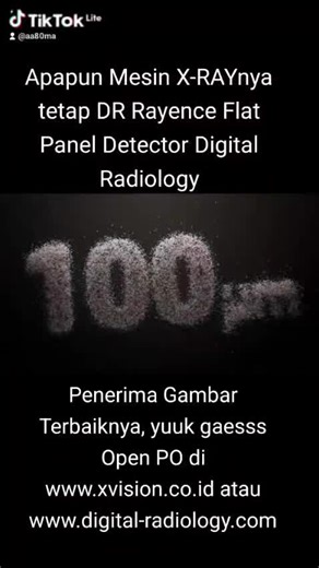 Ready DR Rayence Flat Panel Detector Digital Radiology di www.xvision.co.id
