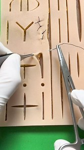 91K views · 853 reactions | Simple Buried Sutures | MF HealthCare | Facebook