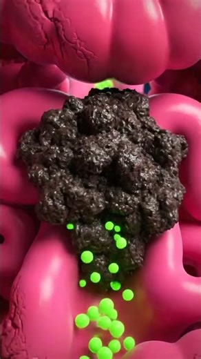 The Hidden Danger: A Blocked Gut Can Ruin Your Gut Health — See It in 3D | Gut Health |