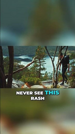 Lyme Disease Without a Rash? Easily Missed Symptoms, Signs & Treatment of Lyme Disease