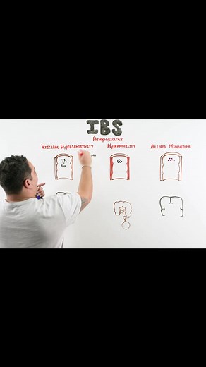 irritable bowel syndrome (IBS) #ninjanerdscience #anatomy #ninjanerdnursing #ninja #ninjanerdmedscience #kristan #kristanninjanerd #ninjanerdteam #ninjanerd #ninjanerdlectures #ninjanerdofficial #ninjanerdmed