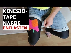 Taping Anleitung: Narbe tapen [Kinesiologie Tape] | BODY TAPE | 2021