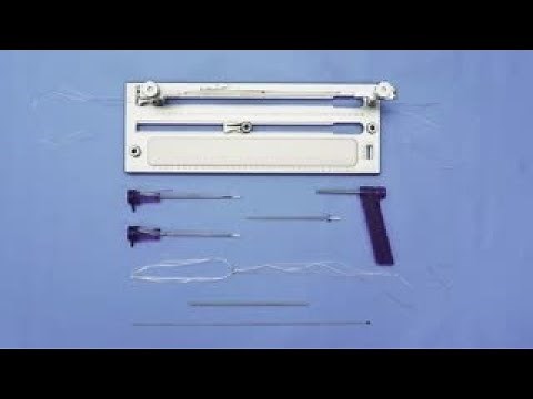 Onlay MPFL Reconstruction Using Hybrid Knee FiberTak® Anchors and a TightRope® II RT Implant