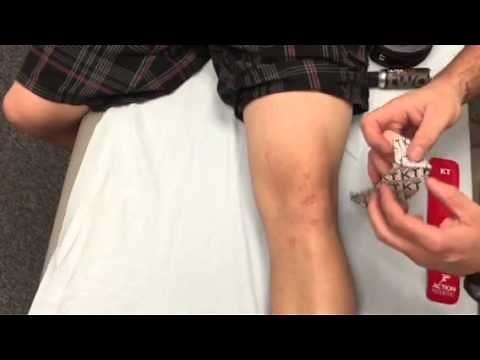 KT Tape Patellar tracking II