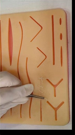 Running suture removal #youtubeshorts #surgicalskills #suturepractice