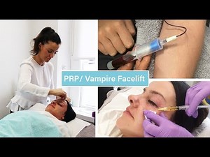 PRP Vampire Facelift | The Laser and Skin Clinic