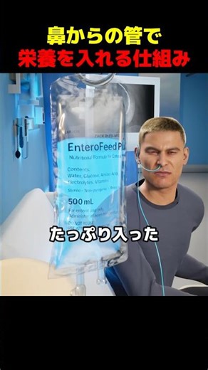Nutrition is given through a tube through the nose