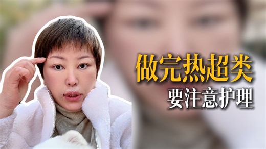 做完热超类项目一定要注意护理 大拉皮术后分享
