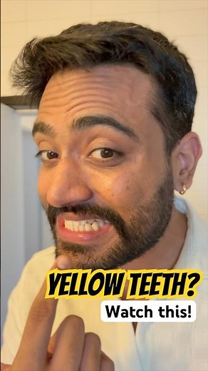 If Your TEETH Look Yellow, Watch This Now | How To Whiten Teeth? Teeth Whitening Toothpaste #perfora