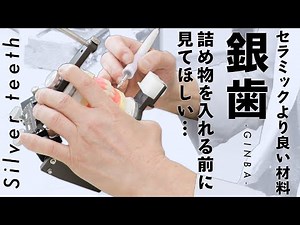 【銀歯】知らないと損をする！本当はとても良い健康保険適用の材料銀歯