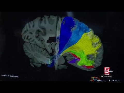 Mapping the brain: Inside an expanding frontier of neuroscience
