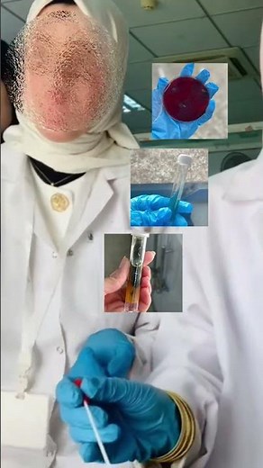 زراعة بكتريا proteus mirabilis واختبارات الكيميائيه لها