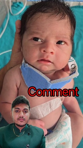 Moro reflex test #mororeflex #newborns #braintest #medicalshorts