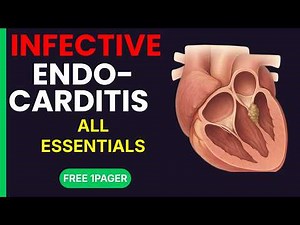 Infective Endocarditis Explained | Case Study, Duke’s Criteria, Treatment & Prevention