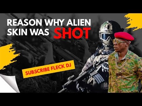 Alien Skin's Car Shot, Singer Escapes Death full details