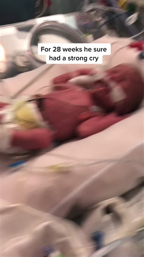 My sweet boy. #preemiemama #preemie #nicu #baby #babycry #preemiecry #28weeker #mylove #babyboy #momtok #pregnancy #ttc