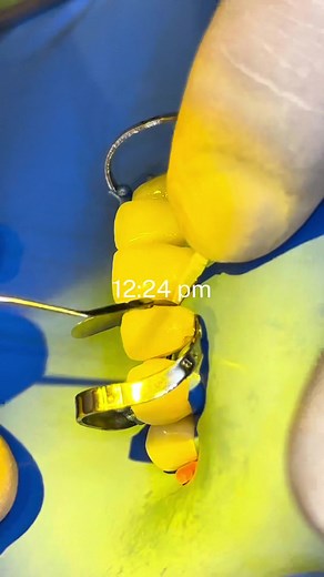 #asmr #reparaciondeceramica #fyp #odontologia