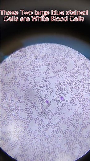 RBC, WBC and Platelets Under Microscope#laboratory #microscope