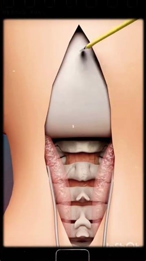 #doctor #3danimation #hospital #anatomy #education 🥰🥰