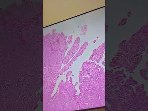 Genitourinary microscope revision