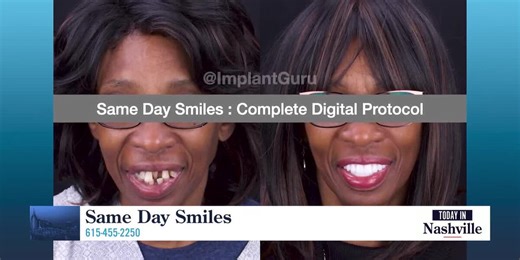 Same Day Smiles Creating New Smiles in One Day