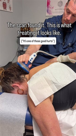 SWAVE Treatment for Neck Instability: No Surgery, No Needles