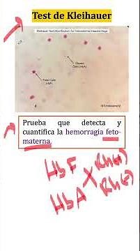 ¿Sabes qué es el test de Kleihauer? #medicina