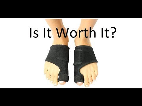 Bunion Splints and Correctors: Are They Worth It? [Doctor Review]