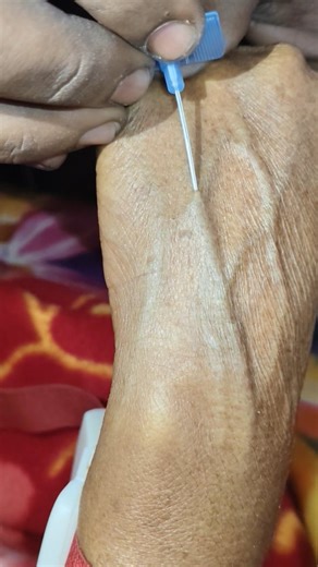 Sonu Sanata | 22G Blue IV Cannula Procedure #trendingreels #foryoupage #reels #viral #explore #explorepage #foryou #trendi #mbbs #neet #doctors | Instagram