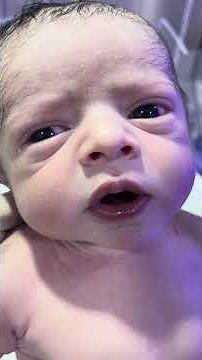 How Beautiful Newborn First Moments | Pure Love & First Cry #NewbornBaby #AdorableBaby