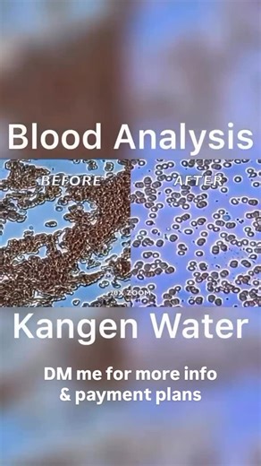 Danielle Batley on Instagram: "Why I talk about Kangen Water & Electrolysed Reduced Water interchangeably. Because the brand matters. Not all hydrogen waters are created equal. Enagic ionisers are certified medical devices by the Japanese Ministry of Health & have been used in their hospitals for decades. Electrolysed reduced water (ERW) is the scientific name for it & is characterised by: • a negative oxidation-reduction potential • micro-clustered structure • dissolved molecular hydrogen • min