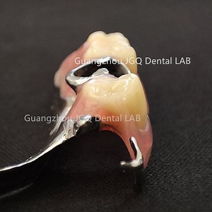 [Hot Item] Conventional Dental Flipper Removable Partial Dentures Metal Framework Best Price Dental Lab