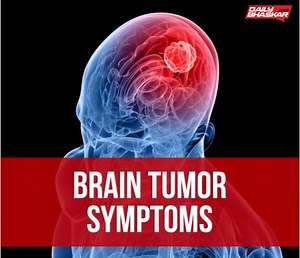 24K views · 255 reactions | Brain Tumor Symptoms | Daily Bhaskar | Facebook