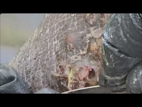 Extreme Jigger Removal | Watch Full Relief and Recovery Process #jigger