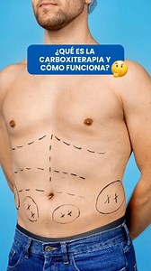 ¿Qué es la carboxiterapia y cómo funciona? 💡¿Sabías que puedes eliminar grasa localizada y mejorar la apariencia de tu piel sin cirugía? 🤩La carboxiterapia utiliza dióxido de carbono para:✨ Mejorar la circulación.✨ Reducir grasa localizada.✨ Desvanecer celulitis.Y lo mejor: en Valdani 21 combinamos este tratamiento con ondas rusas para tonificar y reafirmar tu cuerpo. 💆‍♀️💪👀 Resultados visibles en solo 3 sesiones por 60 soles.🔹 Disponible en todas nuestras sedes:📍 Los Olivos📍 Jesús María