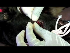 Amazon Cares Dr Patrick Mahaney Bot Fly Extraction 3