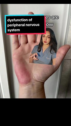 Understanding Dysfunction in the Peripheral Nervous System